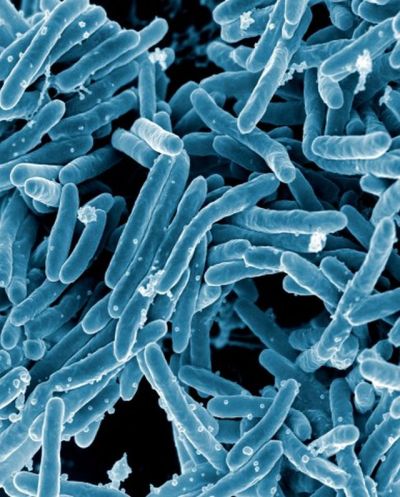 Mycobacterium tuberculosis Bacteria