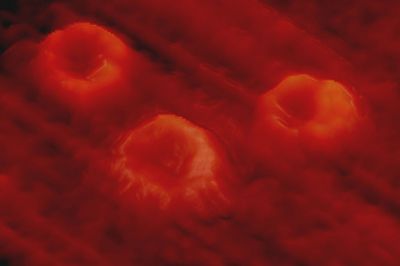 3D Image Human blood smear