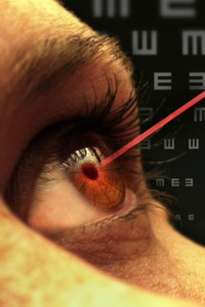 laserowa korekcja wzroku